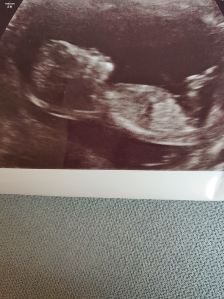 Early Oct babies part 3!