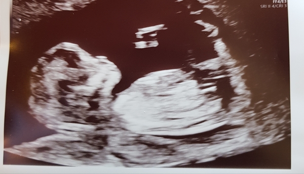 Yet another nub theory gender guess!