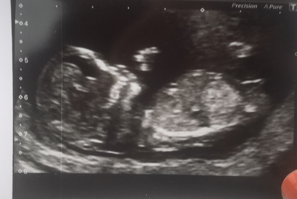 November 2020 Babies - Thread 5