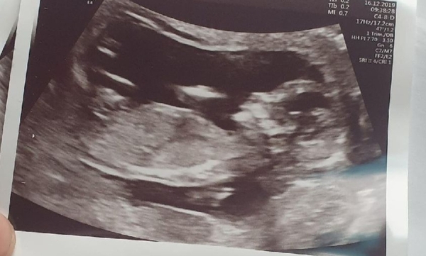 Boy or Girl?