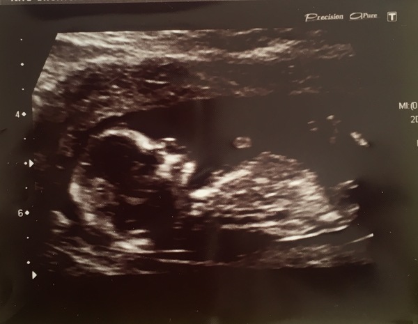 Boy or girl?