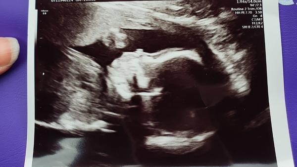 Pregnant after loss and dreaming of rainbows - 2