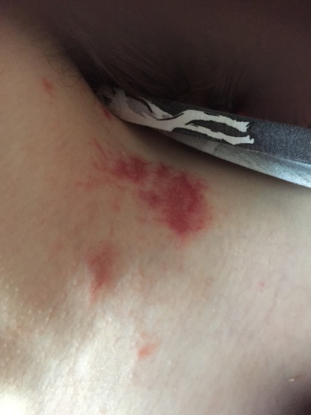 Any GPs or dermatologist about?