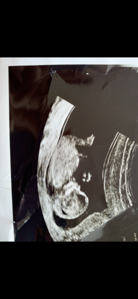Any gender guesses?!