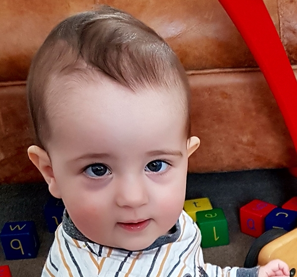 Baby 16 weeks (4 months in 8 days) and still cross eyed?