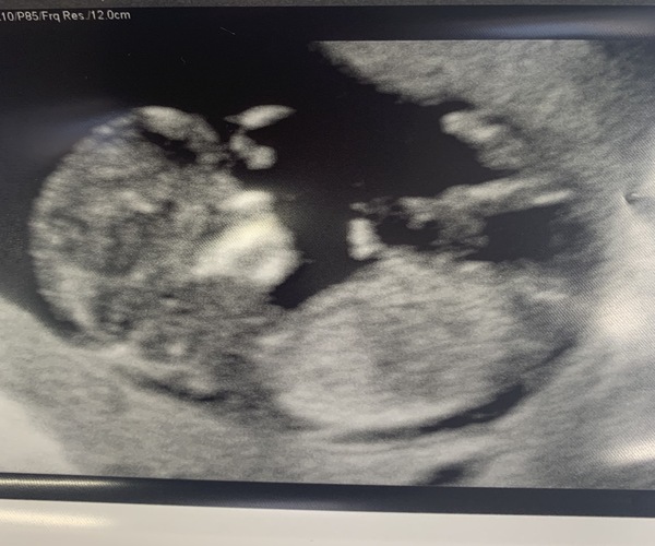 Nub/skull theory guesses