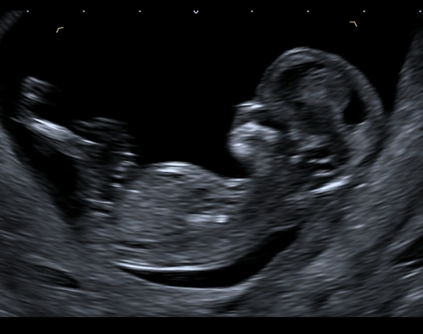 Nub/skull experts please! Boy or girl?