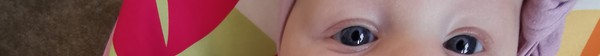 Baby 16 weeks (4 months in 8 days) and still cross eyed?