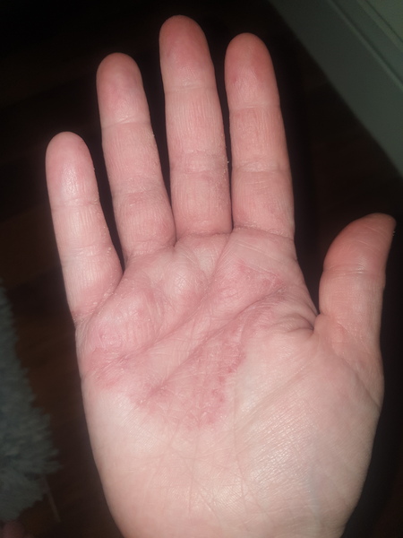 Anyone got any ideas how I can sort my hands out?