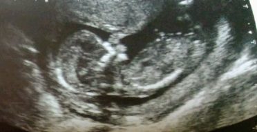 Baby scan guess