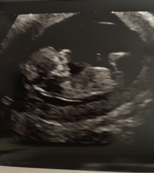 November 2020 Babies - Thread 5