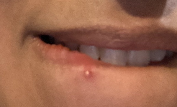 How to get rid of this?!