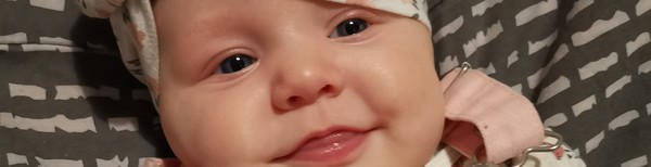 Baby 16 weeks (4 months in 8 days) and still cross eyed?