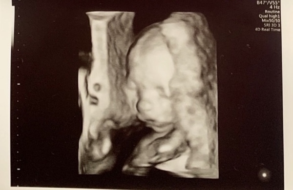 My boyfriend doesn't want our baby