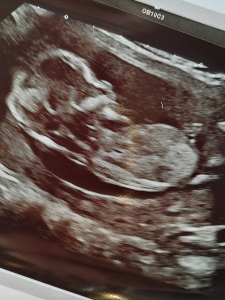 Another guess the sex!
