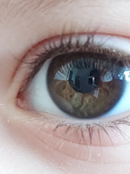 Eye colour