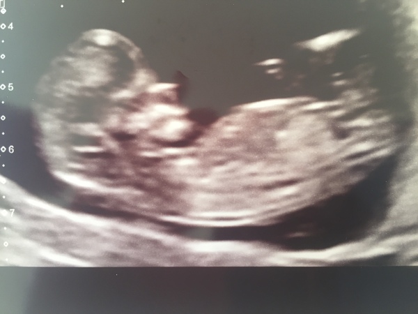 Late October babies - Thread 2