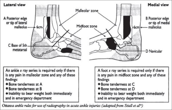 To be scared I may have broken my foot?