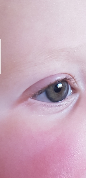 Eye colour