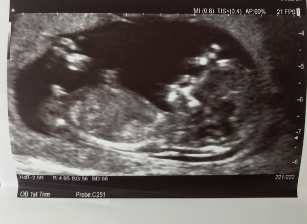 November 2020 Babies - Thread 5