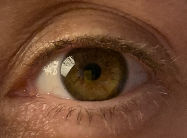 Eye colour