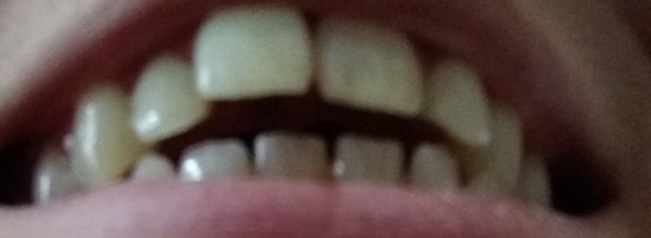 Anyone an orthodontist? desparately need help!.