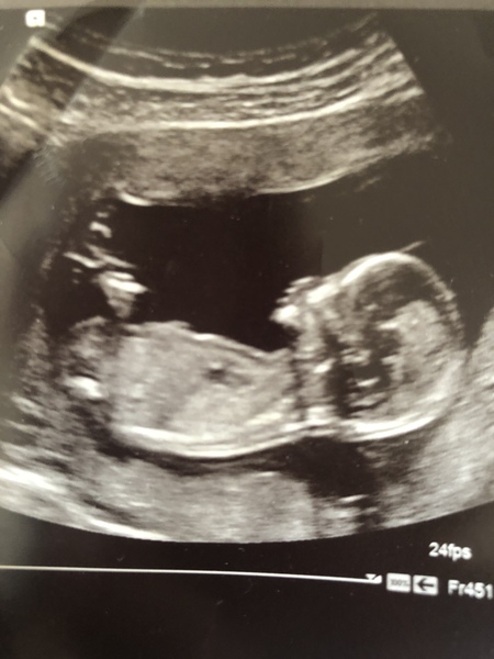 Can anyone guess gender, just fun