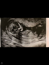 Gender guess!