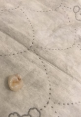 Dental advice please
