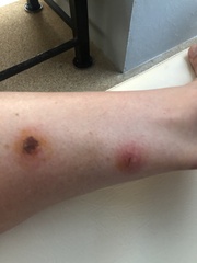 KLAXON..................I have a Bite............