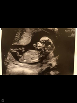 Gender guess!