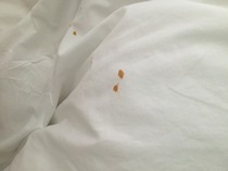 Strange stain on shirt that looks dyed?