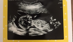Boys or girls guesses .... identical twins