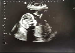 17w5 boy or girl guesses?