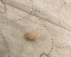 Dental advice please