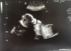 17w5 boy or girl guesses?