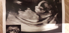 Baby scan guess