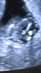 13 week potty shot ... girl or boy?