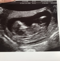 Anyone want to guess the gender :)