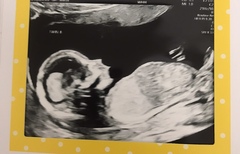 Boys or girls guesses .... identical twins