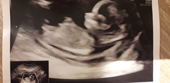 Baby scan guess