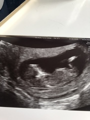 Anyone want to guess the gender :)