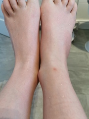 Just a sprain right?