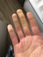 Anyone skilled enough/willing/able to comment on my bloodwork?