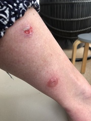 KLAXON..................I have a Bite............