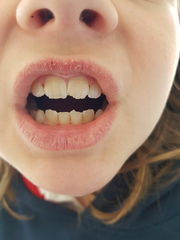 To leave dd's teeth