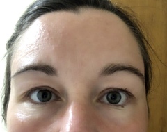 Growing back eyebrows
