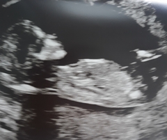 Gender guesses for fun 13 weeks 2 days.