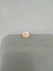 Ds just lost an adult tooth *help*