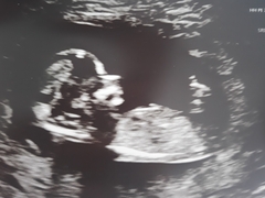 Gender guesses for fun 13 weeks 2 days.